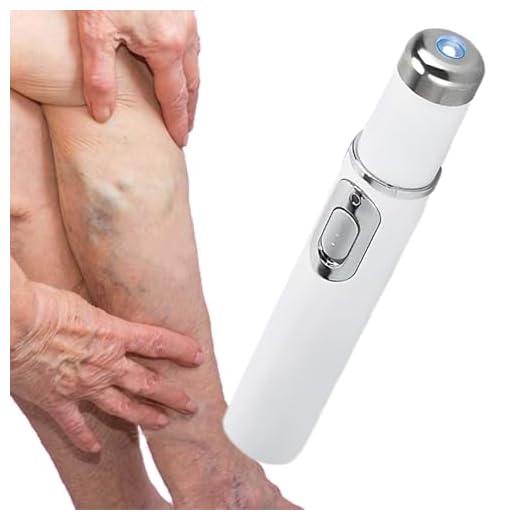 Liakyunf Bolígrafo para Eliminar Arañas Vasculares, Cuidado Diario de la Piel, Bolígrafo Inalámbrico para Venas en Casa, Noche, Postejercicio, Postparto y Camping