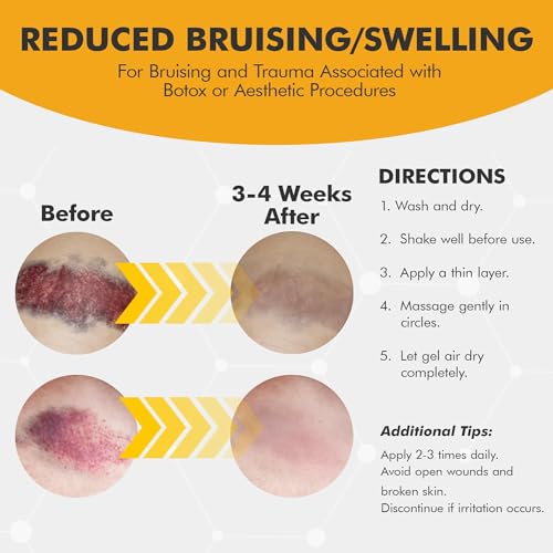 Arnika Forte Topical Roll-On, Arnica Gel for Bruising and Swelling After Surgery, Easy-to-Use Arnica Gel Topical for Post-Surgical Care and Sports Injuries, Clear, 10 ml