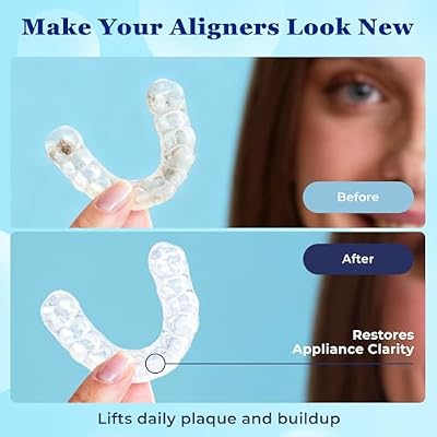 Aligner Cleaner Foam - Aligner and Retainer Cleaner Foam for Invisalign, Night Guards and Dentures, Helps Remove Stains & Build-Up, Keeps Appliances Clear, Fresh Mint Flavor, Travel-Friendly