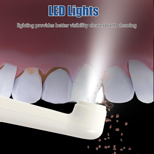 Zahnpolierer, Wiederaufladbare Zahnaufhellung Kit für Zahnreinigung und Aufhellung, Elektrischer Zahnpolierer mit 3-Zahnpolierpaste, 5-Bürstenköpfe, 5-Geschwindigkeitsmodi, LED-Licht – Bild 6