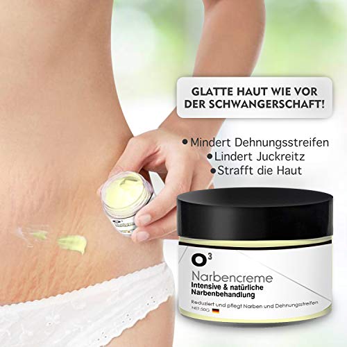 Narbensalbe O³ Narbencreme zur Behandlung von Narben und Dehnungsstreifen