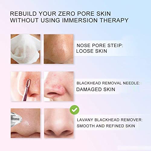 Veentus 4 in 1 Blackhead Whitehead Extractor Remover Device, Acne, Pimple, Pore Cleaner, Vacuum Suction Tool with 4 Suction Head for Men and Women, Blackhead Remover Machine... - Image 3