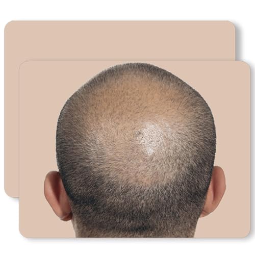 3PCS/Pack Scalp Micropigmentation Practice Skin – Printed SMP Tattoo Training Pad for Hairline...