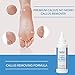 ForPro Professional Collection Premium Callus No More Fast Acting Quick Dry Callus Removing Formula Ounces, White, 4 Fl Oz