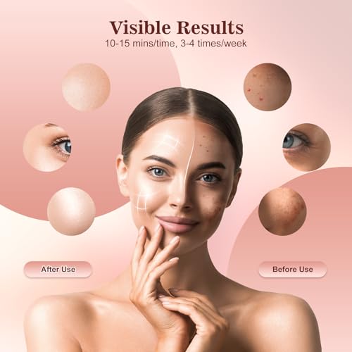 Image of INTEO Red Light Therapy Mask for Face, 850nm NIR, Red /Blue LED Light Mask