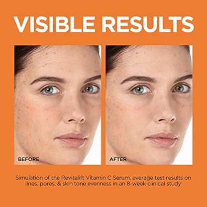 L'Oreal Paris Revitalift 12% Pure Vitamin C Serum, Vitamin E, Salicylic Acid, Brightening 1 oz + Moisturizer Sample - Image 6
