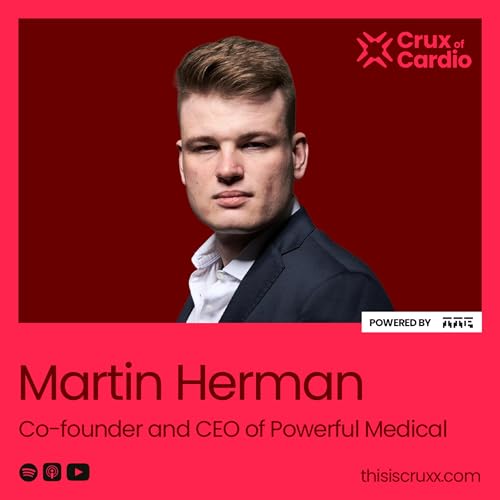 The AI That Reads ECGs Better Than Your Cardiologist with Martin Herman