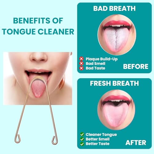 Image of 2Pcs Copper Tongue Scraper, Tongue Cleaner Set for Adults Kids, Stainless steel Wide Double Blades Oral Tongue Brush Cleaning Scrapping Sweeper for Fresh Breath and Mouth Hygiene Care with Travel Bag