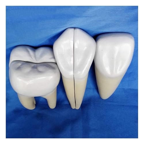 Modèle de dents amovible à taille réelle pour cabinet médical - 2
