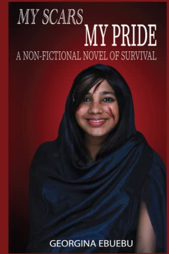 My Scars My Pride: A Non-Fictional Story Of Survival