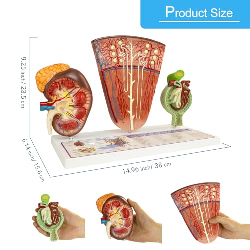 Image of Kidney Model, Human Kidney Nephron and Glomerulus Model, Kidney Anatomy Model for Medical Education Assisted Dissection Suitable for Anatomy Students, Urologists, Patient Consultation