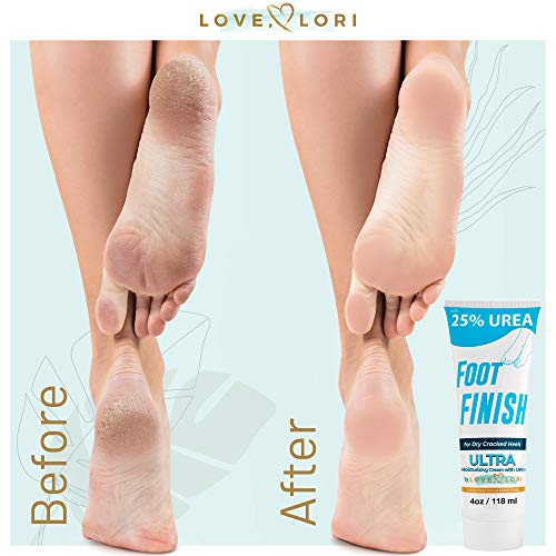 LOVE, LORI Urea Cream 25% Foot Softening Treatment 4 oz Foot Cream for Dry Cracked Heels & Hands - Ultra Repair Cream Intense Hydration for Dry Feet, Knees, Elbows - Stocking Stuffers for Her