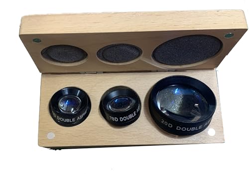 Does phone camera lenses help picture quality