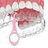Clear aligner removal tool-invisible removable braces, invisible aligner remover-aligner remover-fixer remover (40pcs)