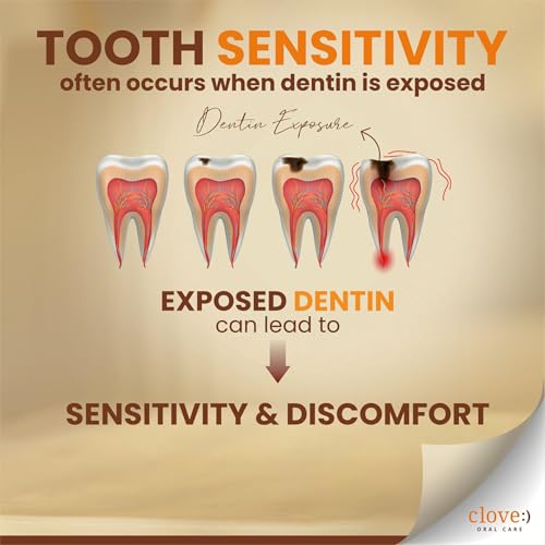 Image of Clove Sensitive Combo Pack | Sensitivity Toothpaste + Pack of 5 Ultra Soft Toothbrushes (Assorted Color) | Reduces Sensitivity, Dual Action for Sensitivity & Bad Breath, Strengthens Enamel | 4160 DuPont Tynex Bristles