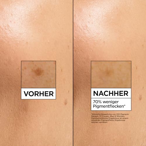 Garnier Vitamin C Aufhellendes Serum gegen Pigmentflecken, Gesichtsserum mit 4 Prozent Vitamin C, Niacinamid, Salicylsäure und Melasyl, für einen strahlenden Teint, für alle Hauttypen, 1 x 30 ml
