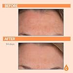 Serious Skincare Vitamin C Serum for Face, Anti-Aging Face Serum with Collagen, Vitamin E, Hydrating Skin Care for Brightening, Improve Appearance of Dark Spots, Tone, Fine Lines & Wrinkles 1 Fl Oz - Image 5