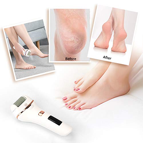 YBLNTEK Elektrische eeltverwijderaar, elektrisch, oplaadbaar, waterdicht, voetverzorging, eeltschaaf, eeltrasp met… - Image 8