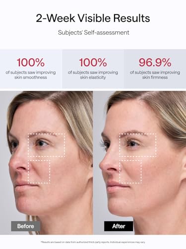 JMOON NouvelleSkin Facial Toning Device, FDA-Cleared Microcurrent Facial Device and Red Light Therapy for Face, 4 Modes & 5 Intensity Levels for Personalized Face Lift & Smoothing. M30U PR