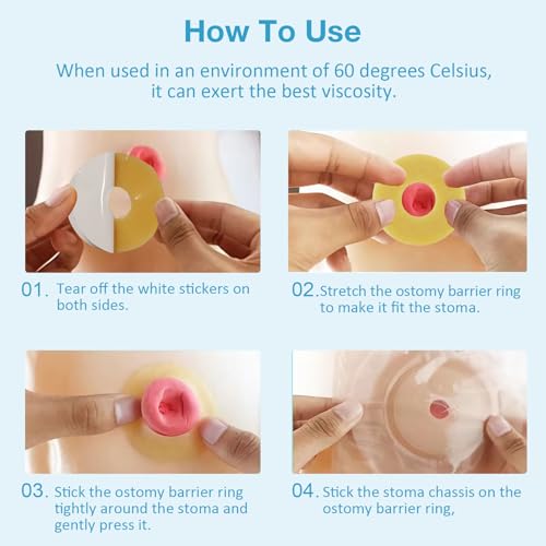 TNTNDAY 20PCS 4mm Moldable Ostomy Barrier Rings, Elastic Skin Extender Rings Outer Diameter 1.9Inch(48mm) Thickness, Medical Hydrocolloid Ostomy Bag Supplies, Better Seal No Leaking Barrier Rings - Thumbnail 6