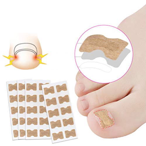 MILISTEN Lijmvrije Teennagel Patch Ingegroeide Teennagel Verwijdering Correctie Patch Voet Nagel Behandeling Tool… - Afbeelding 6