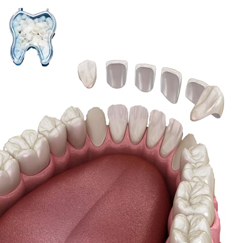 Image of Temporary Tooth Veneer Crowns Kit - 100PCS /Box (50 Anterior + 50 Posterior) - DIY Fake Teeth Cap for Missing Teeth & Natural-Looking Smile Restoration for Holiday Cosplay