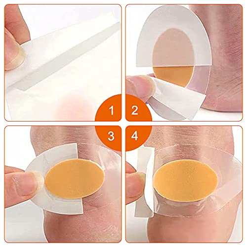 Uymaty Adesivi per cuscinetti sul tallone,50PCS