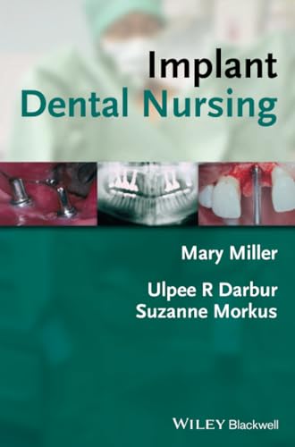 Implant Dental Nursing