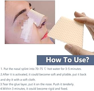 Thermoplastic Nasal Splints - Nose External Support Protector for Nose Brace Fracture, Rhinoplasty Septoplasty Surgery, ENT, Orthopedic Immobilization,5 PCS (S)