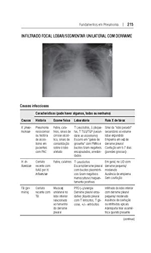 Fundamentos em Pneumonia