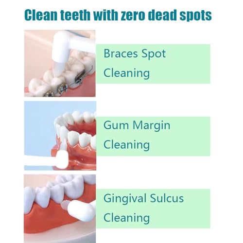 Sufune 5 Stück Tuft Zahnbürste Einbüschelbürste Getuftet Bürste Weich Büschelzahnbürste Kleine Zahnbürste Tuft Toothbrush Zwischenräum Zahnbürste Zahnlücke Bürste für Zahnspange