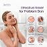 Zinc Soap Bar with Zinc Pyrithione Gentle All-Natural Face & Body Wash Daily Cleansing Formula for Oily, Sensitive & Blemish-Prone Skin Exfoliating Bath Bar Skincare Cleanser Made in USA