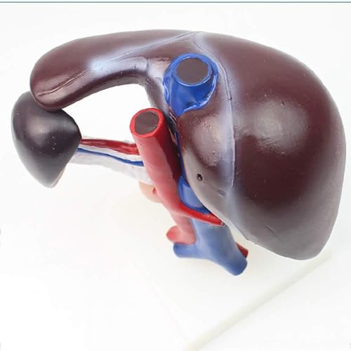 Modèle de pathologie du pancréas AMITD aide à l'apprentissage digestif en anatomie