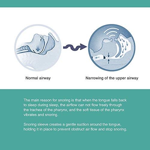 Mouth Type Anti Snoring Tongue Device Transparent Clear Silicone Tongue Tube (Original Version) - Thumbnail 5