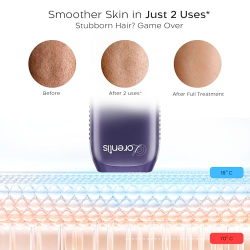 Image of Lorentis IPL laser Hair Removal Device - FDA Approved, Painless & Permanent Hair Reduction for Women & Men - Unlimited Flashes for Face, Body & Bikini - 2 Year Warranty