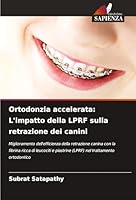 Ortodonzia accelerata: L'impatto della LPRF sulla retrazione dei canini (Italian Edition) 3639865847 Book Cover