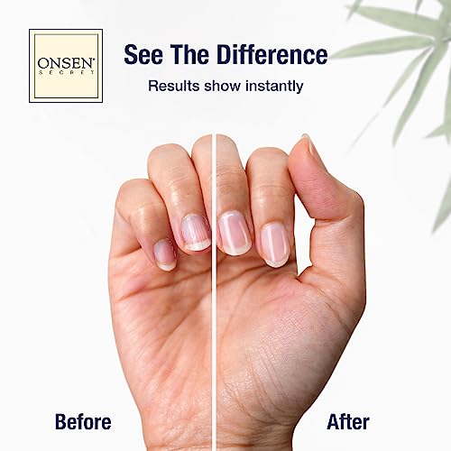 Onsen Secret Ultimate Nail Reboot Kit - Professional Nail File and Buffer, 3-Way Block w/Replacement Pads, Nail Strengthening Cuticle Cream, Reboot Oil & Anti Aging Hand Lotion - Thumbnail 2