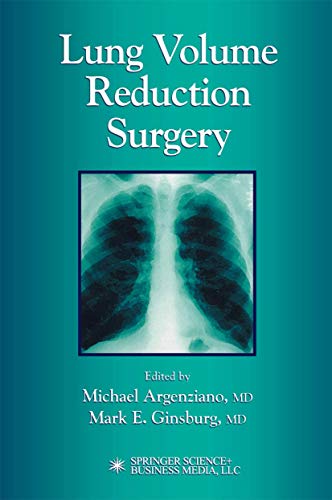 Lung Volume Reduction Surgery view 2