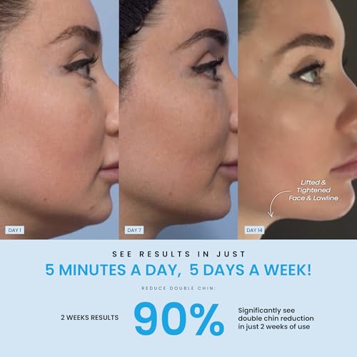 LiftLab Escultor de pele – Massageador facial e pescoço com luz LED 3 em 1 – rejuvenescimento, relax