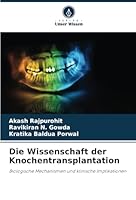 Die Wissenschaft der Knochentransplantation: Biologische Mechanismen und klinische Implikationen (German Edition) 6208734436 Book Cover