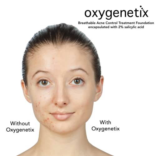 Oxygenetix Acne Control Foundation - 15Ml - Opal #TOP3