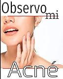  Observo mi acné: Moderar el acné a diario, con seguimientos de los síntomas, la dieta, los tratamientos, la intensidad del dolor, etc... 8X10, 101 páginas