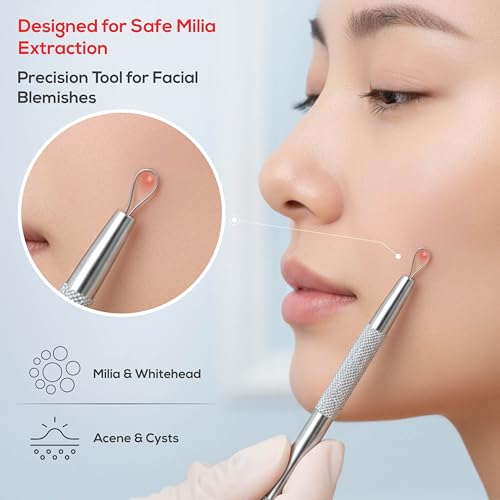 Suvorna Pimple Popper Tool Kit & Milia Remover, 4-Piece Stainless Steel Blackhead Extractor, Whitehead & Comedone Extractor with Lancets for Facial Extraction - Image 5