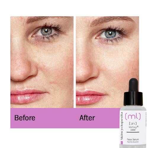 The Ordinary Matrixyl 10% + HA Gezichtsserum – 30 ml - View 1