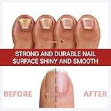 Keratin & Vitamin C Nail Cuticle Oil, Nail Strengthener for Weak & Damaged Nails, Deep Moisture with Keratin Protein to Improve Cracked Nails & Rigid Cuticles - Image 5