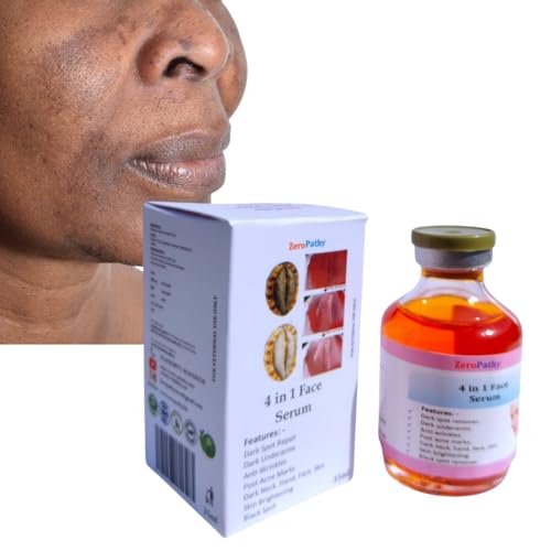 Face Cream For Women & Men  Tan & dark Spot