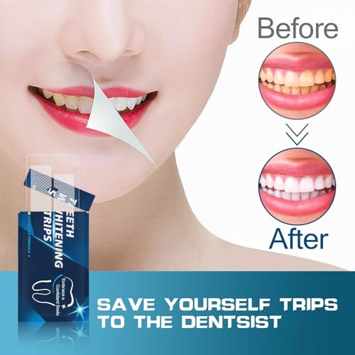Image of Teeth Whitening Strips - 14 Whitening Strips for Teeth Sensitive, Professional, Fast Remove Smoking, Coffee, Wine Stains, Teeth Whitening Kit Pack of 7 Non-Slip Strips Treatments