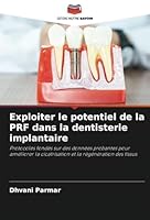 Exploiter le potentiel de la PRF dans la dentisterie implantaire: Protocoles fondés sur des données probantes pour améliorer la cicatrisation et la régénération des tissus (French Edition) 620881717X Book Cover