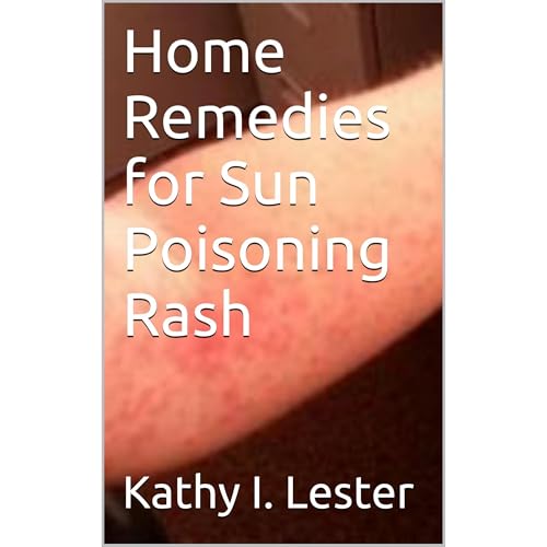 Home Remedies for Sun Poisoning Rash Audiolibro Por Kathy I. Lester arte de portada