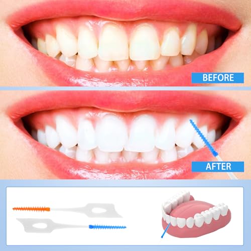 200 Stück Interdentalbürsten, Silikon Zahnzwischenraumbürsten Dentalbürsten mit Box, Tragbarer Dual-Use Zahnseide Stick für Zahnreinigung Zwischenräume (Grün, Orange) – Bild 6